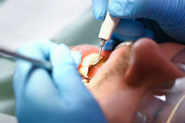 Best Emergency TMJ Treatment in Bee Ridge, FL