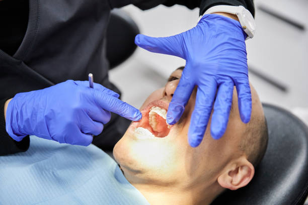 Best Emergency Dental Care for Broken or Chipped Teeth in Bee Ridge, FL